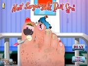 Nail Surgery Foot Spa