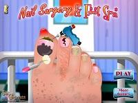 Nail Surgery Foot Spa