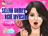 Selena Gomes Acne Invasion